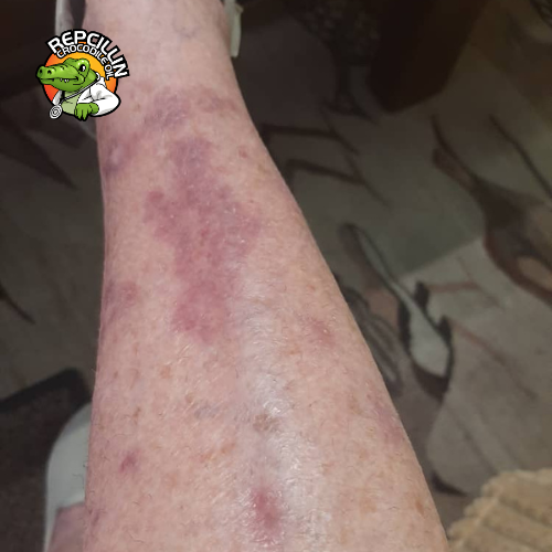 Sonja Friedschroder - Before