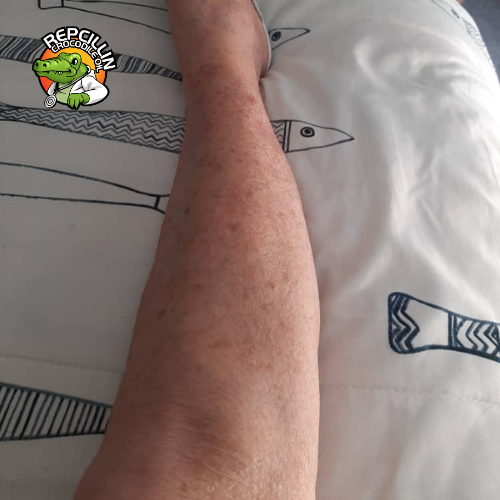 Sonja Friedschroder - After