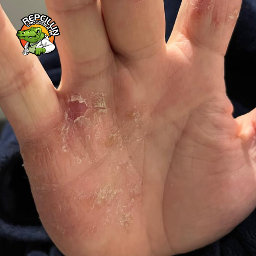 Nadine Jansen van Rensburg - Before