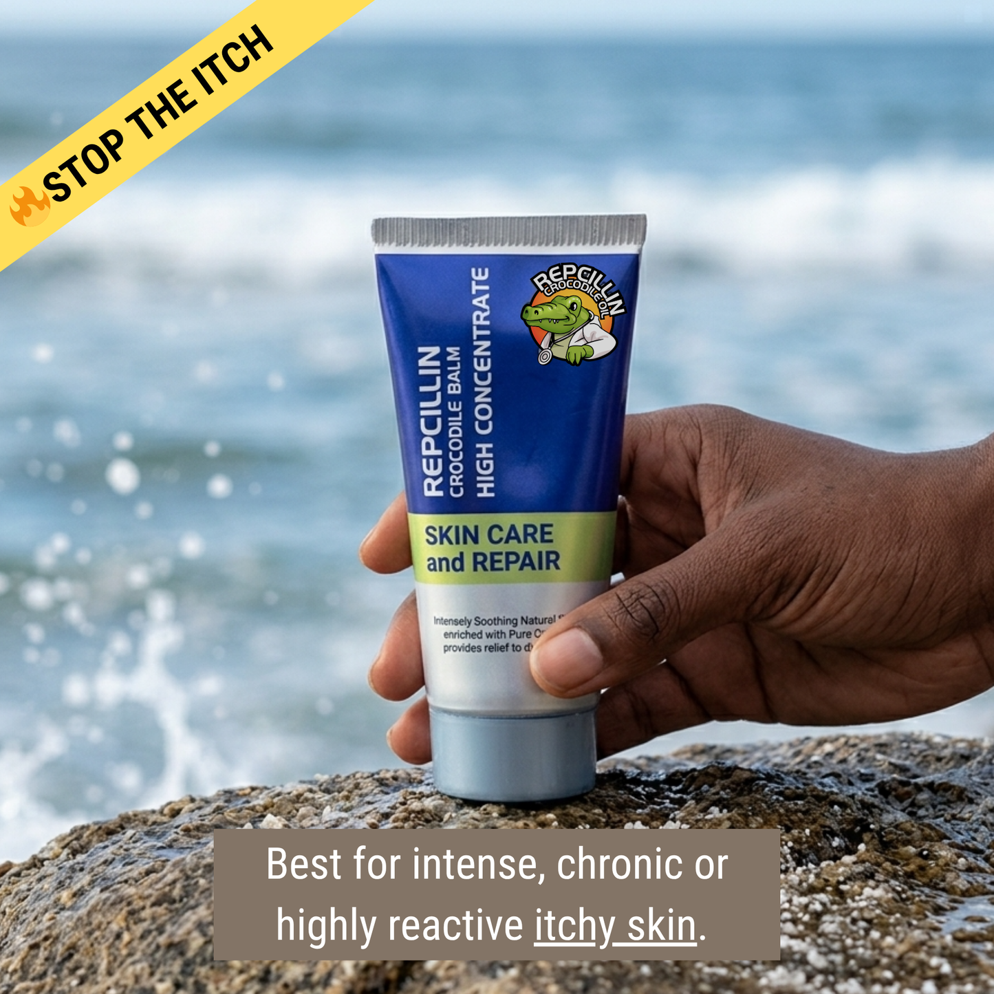 Stop The Itch Cream - Repcillin High Concentrate 50ml